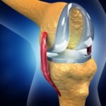Knee