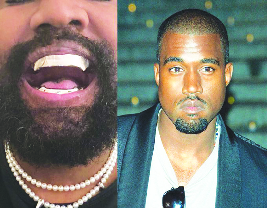 Kanye West replaces teeth with titanium gnashers - The Shillong Times